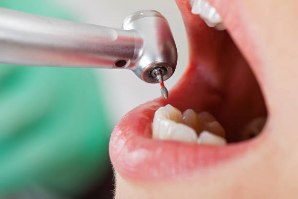 Best Dentist for Severe Toothache  in Priest River, ID